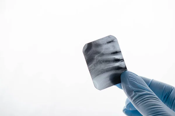 Vista ritagliata del dentista in guanto di lattice che tiene i raggi X dei denti sul bianco — Foto stock