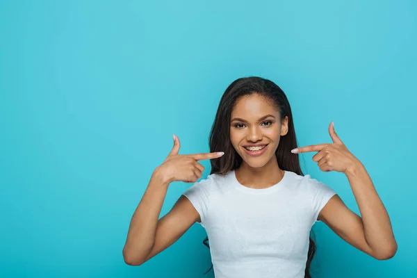 Happy african american girl smiling at camera while pointing at braces on her teeth on blue background — Stock Photo