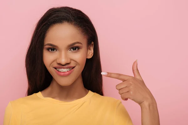 Sorridente ragazza afro-americana che punta con il dito ai bretelle dentali dei denti isolati su rosa — Foto stock