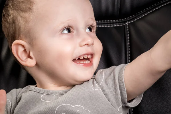 Child Had Bad Tooth Caries Early Age Pediatric Dentistry — Stock Photo, Image