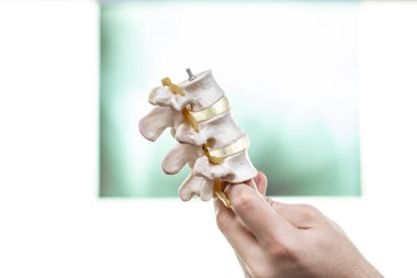 Yapay insan omurga modelinin anatomisini gösteren bir beyin cerrahı. Arka planda bel röntgeni..