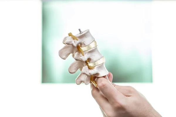 Neurosurgeon Pointing Demonstrating Anatomy Artificial Human Cervical Spine Model Lumbar — Stock Photo, Image