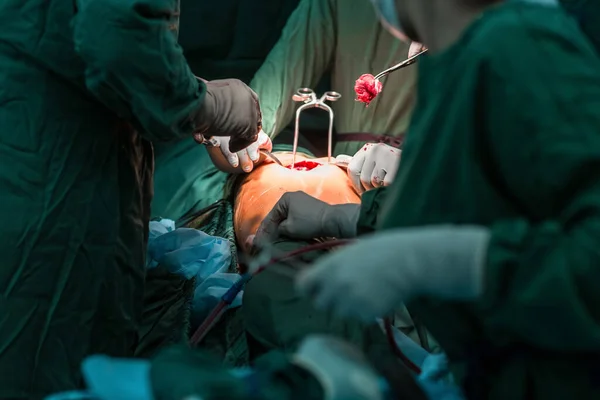 Χειρουργική Επέμβαση Συρραφής Πληγή Της Sacroma Υποκαπνισμό Radivac Αποχέτευσης Καλύτερη — Φωτογραφία Αρχείου