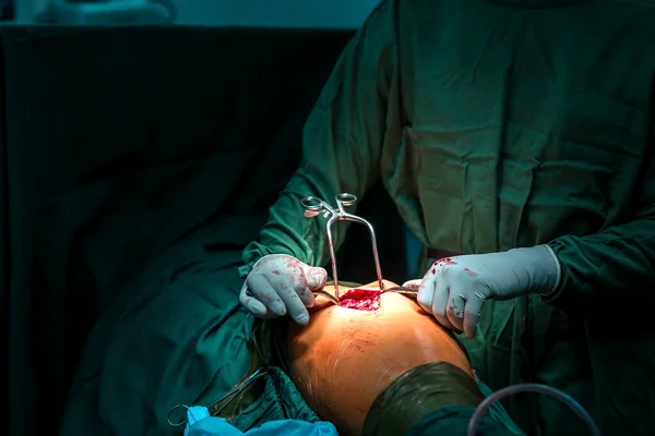 Cirurgia Sala Cirurgia Com Equipamentos Eletrocautério Para Centro Cirurgia Emergência — Fotografia de Stock