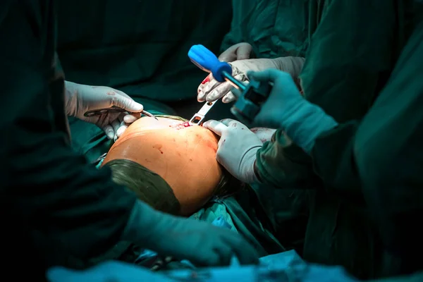 Heupgewrichtsoperatie Groep Chirurgen Operatiekamer Met Chirurgische Apparatuur Medische Achtergrond — Stockfoto