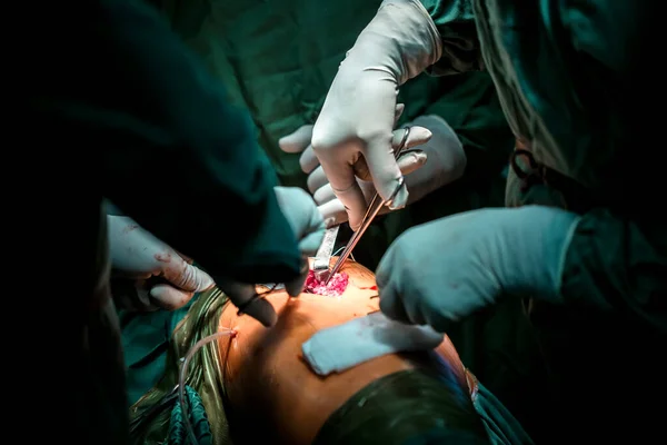 Χέρι Των Χειρουργών Επιλέγει Όργανα Της Χειρουργικής Επέμβασης Στο Χειρουργείο — Φωτογραφία Αρχείου