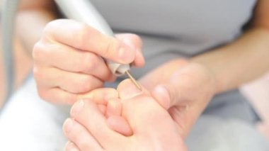 Kadın usta bir erkeği iyileştirir..