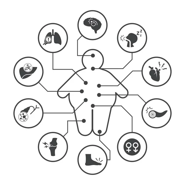 Complicaciones médicas de la obesidad, iconos vectoriales — Vector de stock