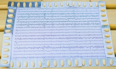 Nörolojik epilepsi inceleme
