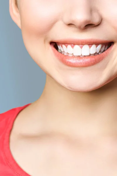 Dentes saudáveis perfeitos sorriso de uma jovem mulher. Clareamento dos dentes. Paciente da clínica dentária. Imagem simboliza odontologia cuidados orais, estomatologia. Imagem da Odontologia . — Fotografia de Stock