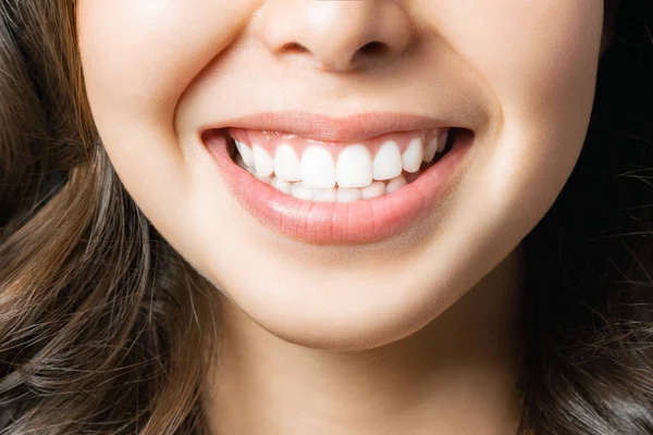 Sonrisa de dientes sanos perfectos de una mujer joven. Blanqueamiento dental. Paciente de la clínica dental. La imagen simboliza el cuidado bucal odontología, estomatología — Foto de Stock