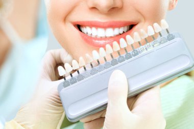 Close up portrait of Young women in dentist chair, Check and select the color of the teeth. Dentist makes the process of treatment in dental clinic office. Teeth whitenning