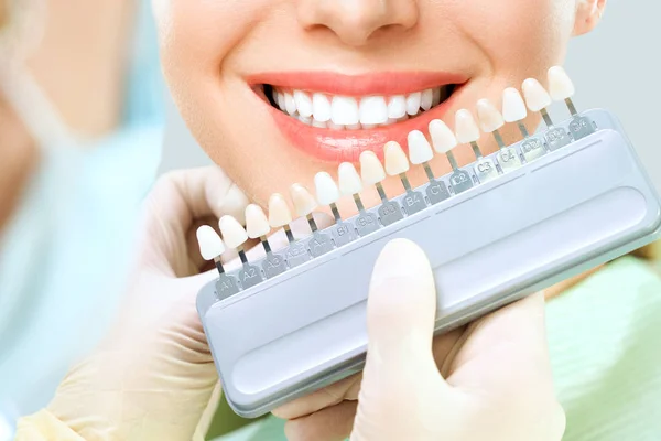 Close up retrato de mulheres jovens em cadeira de dentista, Verifique e selecione a cor dos dentes. Dentista faz o processo de tratamento em consultório de clínica odontológica. Branqueamento dos dentes — Fotografia de Stock