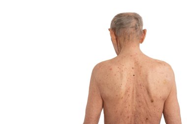 Beyaz saçlı yaşlı adam, üstsüz yaşlı adam beyaz arka planda izole edilmiş kameranın karşısında duruyor.