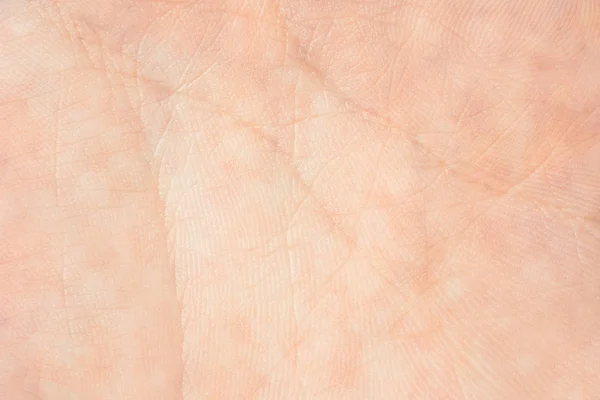 Textura de la piel — Foto de Stock
