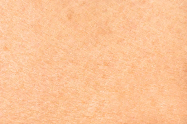 Texture of the skin — Stock Photo, Image