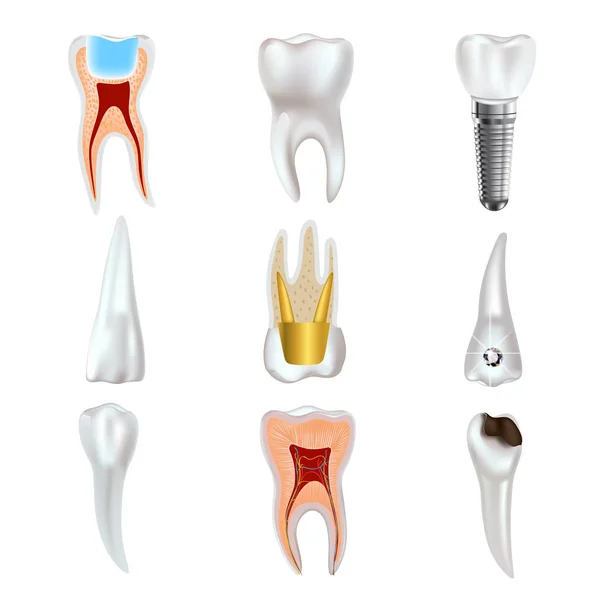 Implante dental y conjunto de iconos de anatomía dental real . — Vector de stock