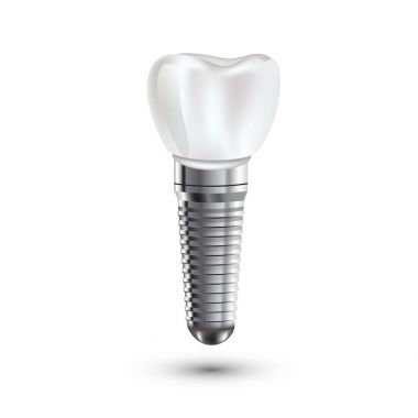 Dental implant gerçekçi anatomi illüstrasyon.