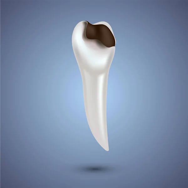 Реалістичні зуби анатомія ілюстрація . — стоковий вектор
