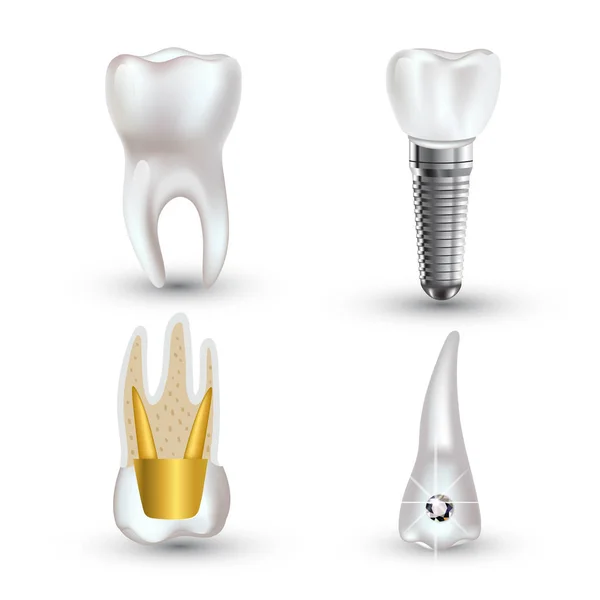 Conjunto vectorial de dientes limpios y sucios realistas 3d aislados sobre fondo blanco. Concepto de salud dental. Cuidado bucal, restauración dental — Vector de stock