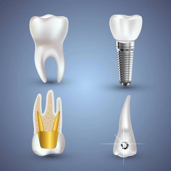 Conjunto vectorial de dientes limpios y sucios realistas 3d aislados sobre fondo gris. Concepto de salud dental. Cuidado bucal, restauración dental — Vector de stock