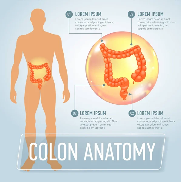 Ilustración de banner de infografías de colon vectorial — Vector de stock