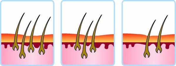 Ciclo Crecimiento Del Cabello Signo Gráfico Ilustración — Vector de stock