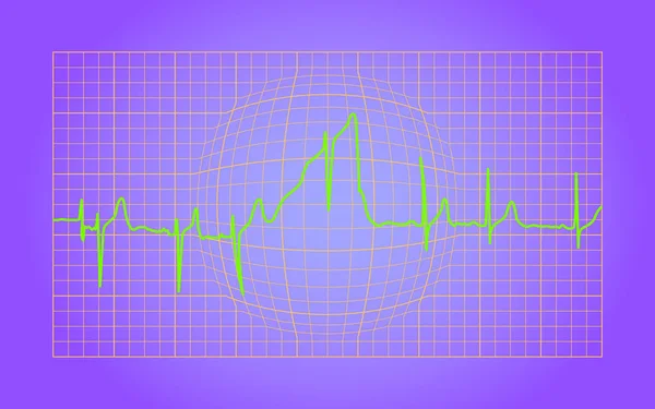 Eletrocardiograma Coração Saudável —  Vetores de Stock