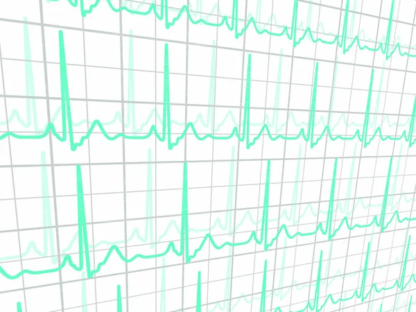 Totalmente Editável Está Localizado Grupo Separado Cardiograma Cardíaco Arquivo Vetorial —  Vetores de Stock