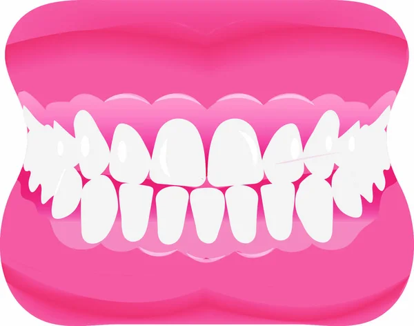 Dişli Bir Çene Düz Bir Şekil Ağzını Takma Dişler Diş — Stok Vektör