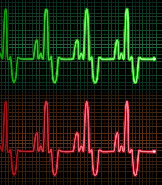 Electrocardiogramas Vectoriales Del Corazón Humano — Vector de stock