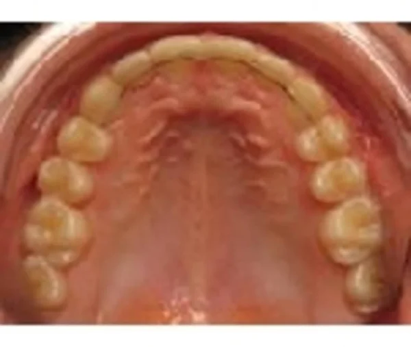 歯列矯正術または科学の魔法 — ストック写真