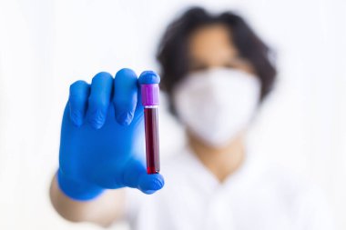 Türkiye 'de plazma için kan testi sonucu tutan eldivenli genç bir doktor