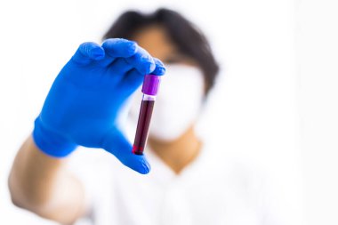 Türkiye 'de plazma için kan testi sonucu tutan eldivenli genç bir doktor