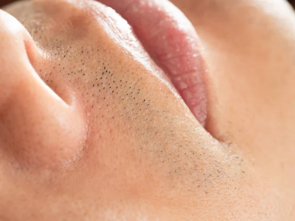 Cicatrizes Barbear Masculinas Close — Fotografia de Stock