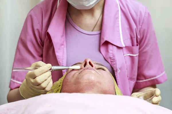 Cosmetólogo utiliza un cepillo para aplicar una mascarilla calmante y transparente a la piel enrojecida de la cara de los pacientes, después del peeling químico . —  Fotos de Stock