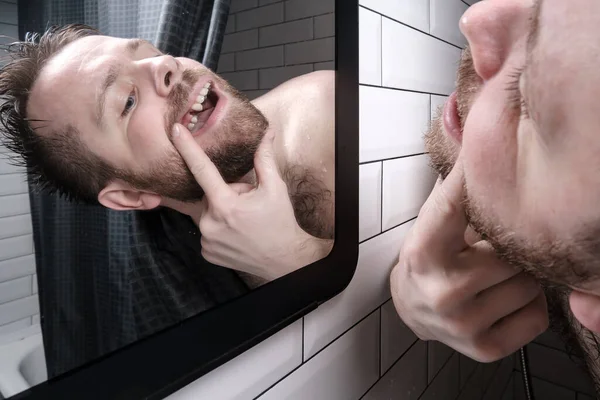 Man opened his mouth and carefully examines the absence of a tooth in mirror, peering out from behind the curtains in the shower. — Stock fotografie