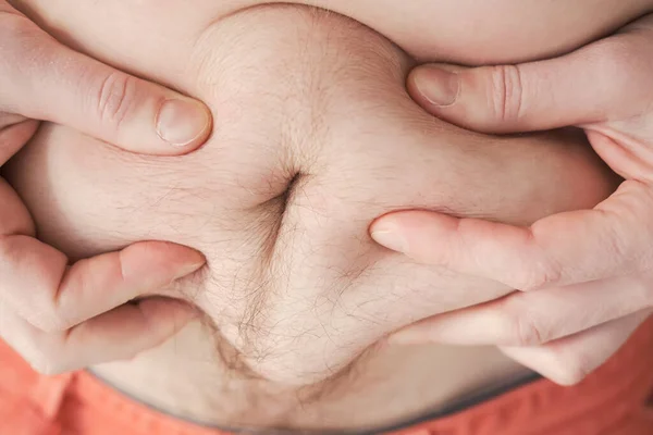 Mãos de um homem segurando o excesso de gordura no estômago, close-up. Pessoa com excesso de peso. Conceito de estilo de vida saudável . — Fotografia de Stock