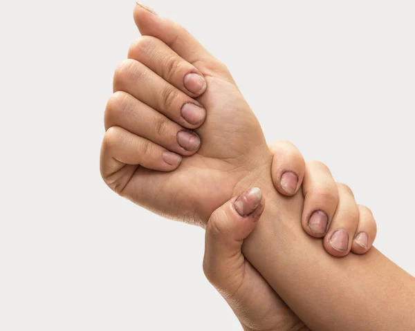 Mãos femininas com unhas sujas — Fotografia de Stock