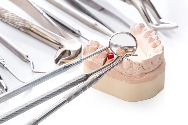 Гипсовая модель челюстей и стоматологических инструментов — стоковое фото