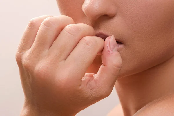 Woman bitting her fingers — Stock Photo, Image