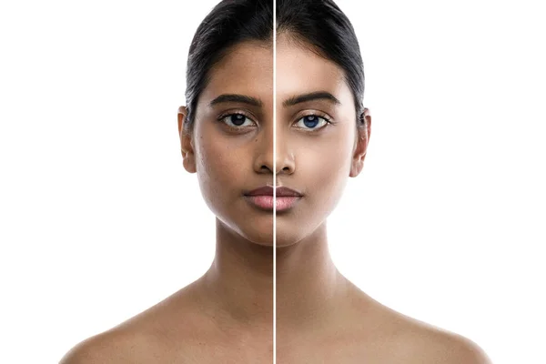 Transformation Young Indian Woman Result Plastic Surgery Retouch White Background — Stock Photo, Image