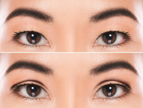 Primer Plano Los Ojos Femeninos Después Blefaroplastia Asia Oriental Cirugía —  Fotos de Stock