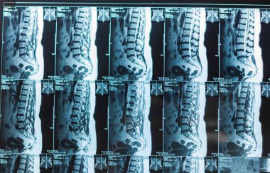 Bacak ve kalça röntgenleri.