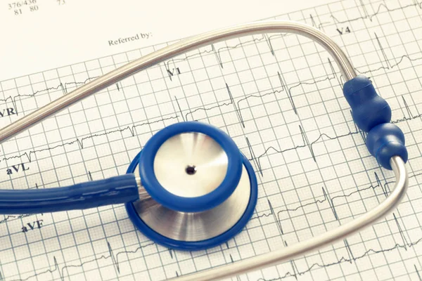 Stethoscope with ekg cardiograms chart. Filtered image: cross processed vintage effect. — Stock Photo, Image
