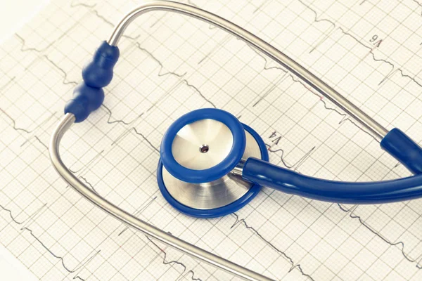Stethoscope with ekg cardiogram chart. Filtered image: cross processed vintage effect. — Stock Photo, Image