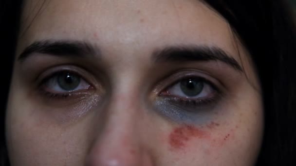 家庭内暴力の戦闘中の女性犠牲者の目のクローズアップ. — ストック動画