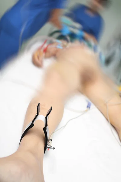 Kaki elektrokardiogram mengarah pada pasien di UGD — Stok Foto