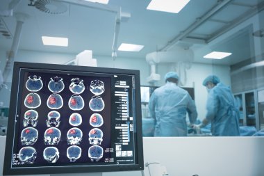 X-ışını izleme altında beyin cerrahisi