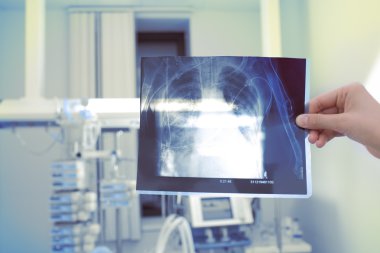 X-Ray görüntü doktor elinde